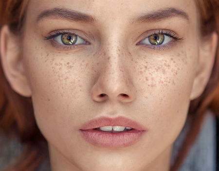 FRECKLING: Tetoviranje pjegica osvaja svijet!